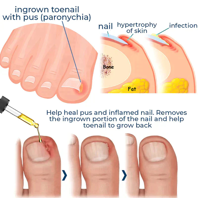 Nails Repair Serum - Growth Nails